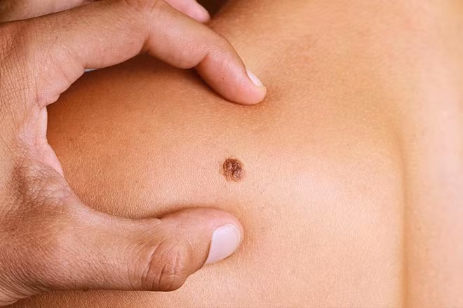 9 vấn đề sức khỏe có thể xảy ra khi nắng nóng 40 độ C