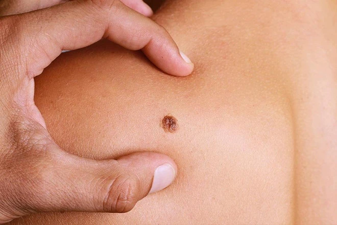 9 vấn đề sức khỏe có thể xảy ra khi nắng nóng 40 độ C