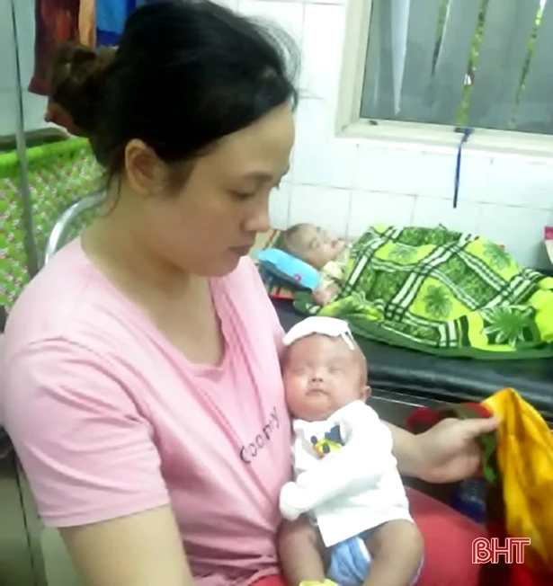 Bố mẹ bất lực nhìn con song sinh vật vã bởi căn bệnh não úng thủy