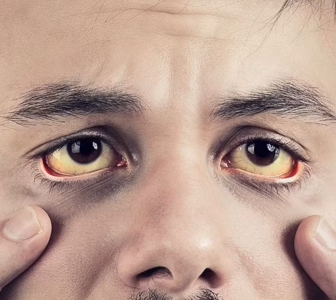 Dấu hiệu bất thường trên cơ thể cảnh báo sức khỏe có vấn đề