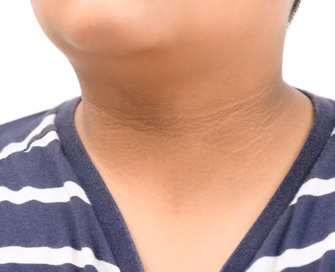 Dấu hiệu bất thường trên cơ thể cảnh báo sức khỏe có vấn đề