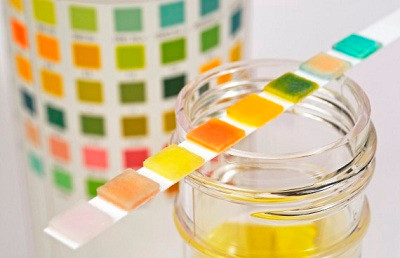 Thay đổi màu sắc nước tiểu cảnh báo nguy cơ về sức khỏe