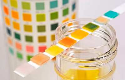 Thay đổi màu sắc nước tiểu cảnh báo nguy cơ về sức khỏe