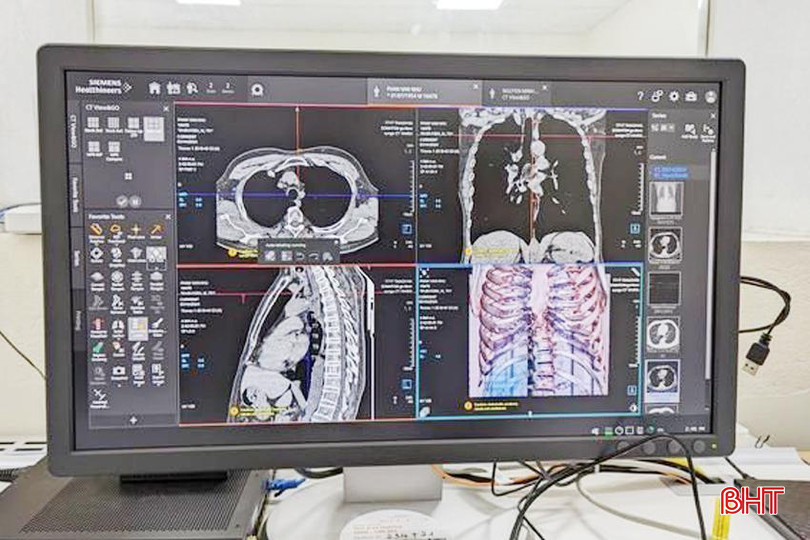 Nhiều phần mềm trong chẩn đoán hình ảnh được các cơ sở y tế áp dụng. thach ha 5A.jpg