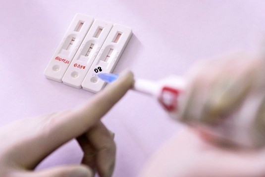 Bộ xét nghiệm phát hiện biến thể Omicron được đăng ký tại Nga