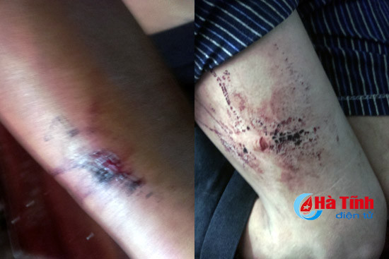 den nha hang xom uong nuoc che bi nguoi la dam nhieu nhat