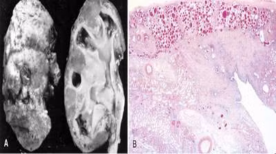 canh bao suy than man o tuoi hoc duong