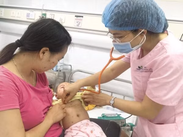 thuy dau vao mua bac si huong dan cach phong benh hieu qua