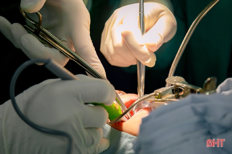 Cắt amidan theo phương pháp mới tại Trung tâm Y tế Hương Sơn