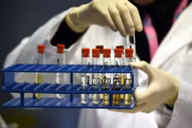 Chấn động hậu SEA Games: 3 VĐV dính doping, 1 HCV có chất cấm