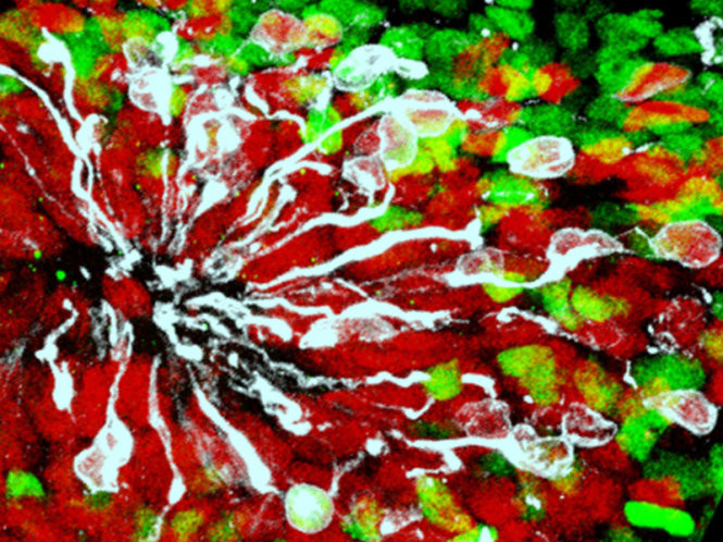 Ảnh chụp não mini bị virus Zika (màu trắng) tấn công - Ảnh: Xuyu Qian và Guo-li Ming tao thanh cong nao mini giup nghien cuu cach chong virus