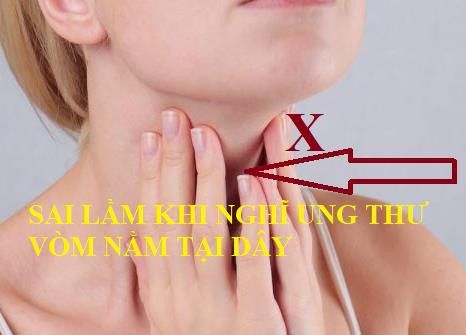 phát hiện sớm ung thư vòm mũi họng hình 1 Phát hiện sớm ung thư vòm mũi họng