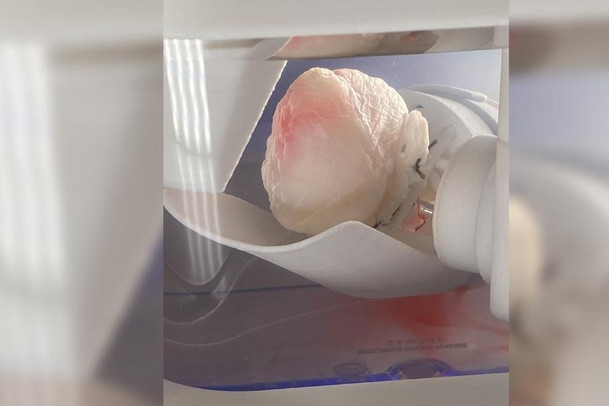 “Trái tim ma” mở ra hy vọng mới cho bệnh nhân cần cấy ghép tim