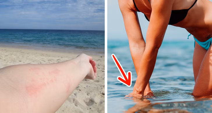 11 mẹo sơ cứu ban đầu bạn nên biết