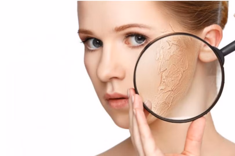 Cách cải thiện giúp làn da mịn màng chỉ trong 1 tuần