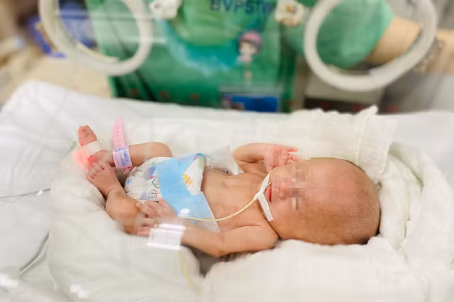 Kỳ diệu: Cứu sống và nuôi dưỡng thành công trẻ sơ sinh nặng 400gram đầu tiên tại Việt Nam
