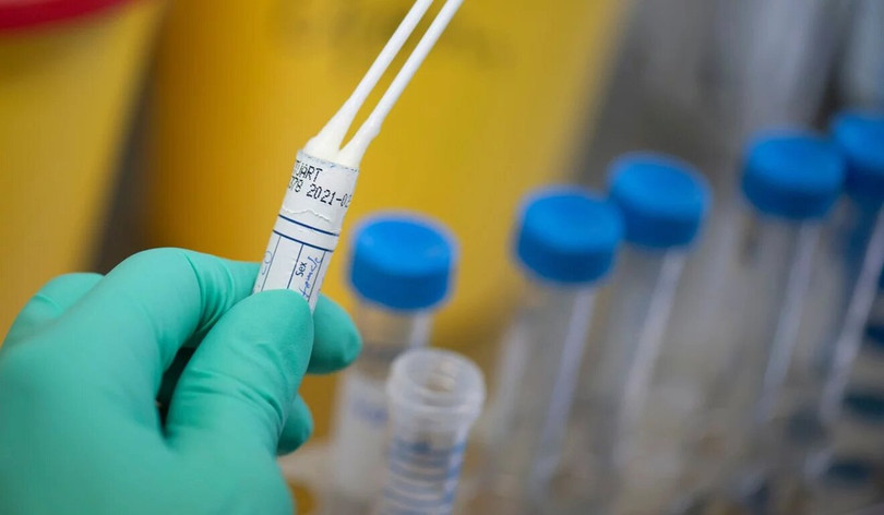 Hiểu được cơ chế tàn phá của virus cũng như cơ chế phản kháng của cơ thể là thiết yếu trong việc chống virus. Ảnh: AFP . Trận chiến khốc liệt giữa hệ miễn dịch người với virus corona