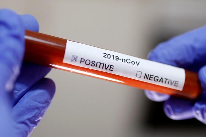 Thêm 2 ca mắc Covid-19 ở Long An và An Giang, nâng tổng số ca lên 118