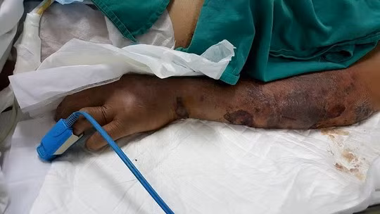 6 su that khung khiep ve cac loai tiet canh made in nha lam