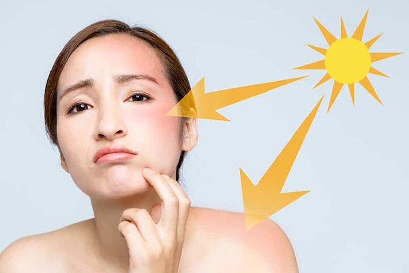 Tia UV gây tổn hại nhiều đến làn da kham-da-lieu-2.jpg