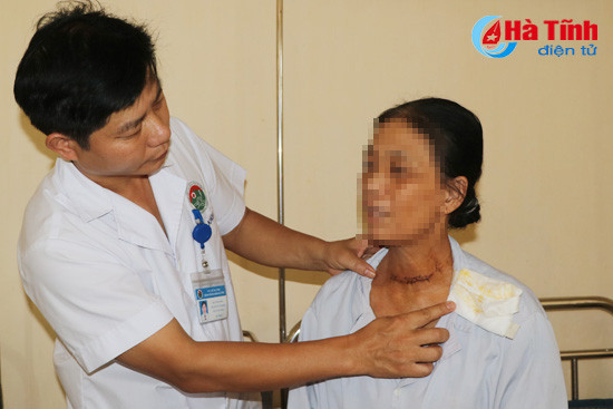 bvdk ha tinh lan dau phau thuat cat toan bo tuyen giap dieu tri ung thu