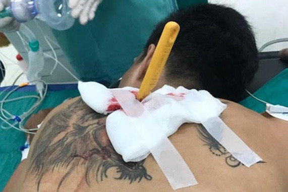 nam thanh nien xam tro bi ban gai cam dao dam lut can