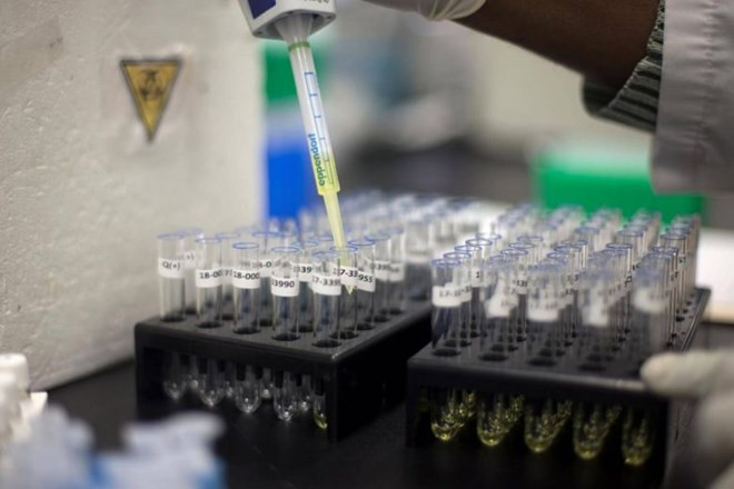 nhat thu nghiem phuong phap xet nghiem nuoc tieu phat hien ung thu