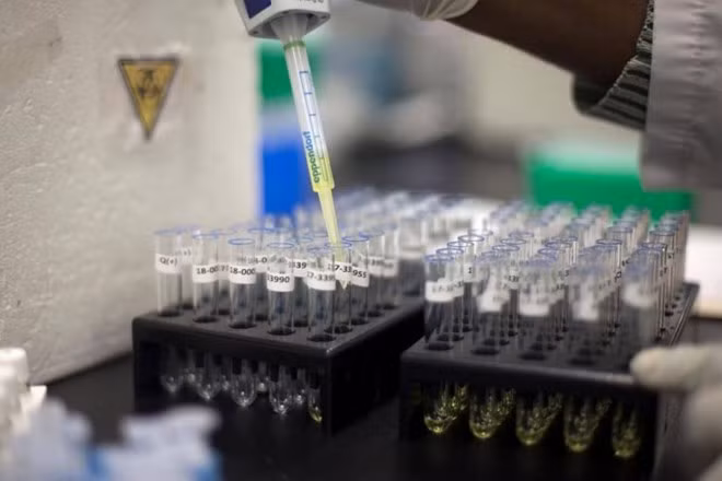 nhat thu nghiem phuong phap xet nghiem nuoc tieu phat hien ung thu