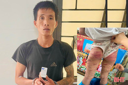 Bắt giữ cha dượng nghi bạo hành bé gái lớp 5 
