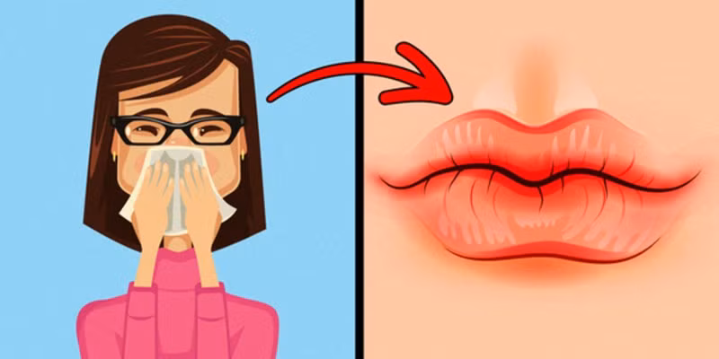 8 dấu hiệu trên môi cảnh báo sức khỏe có vấn đề