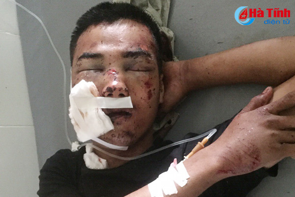 phat hien nguoi dan ong bi thuong nang nam bat tinh ben duong tau