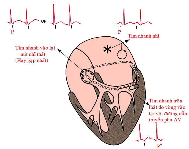 khuyen cao hoi chung tim sau ky nghi le