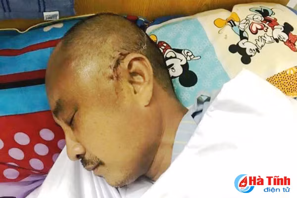 mot can bo bao ve rung bi tai nan nguy kich tren duong tuan tra