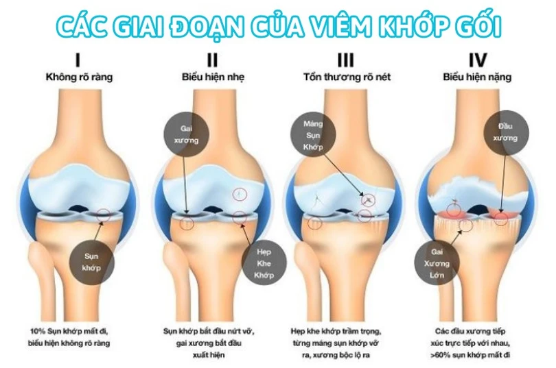 Điều trị 3.jpg