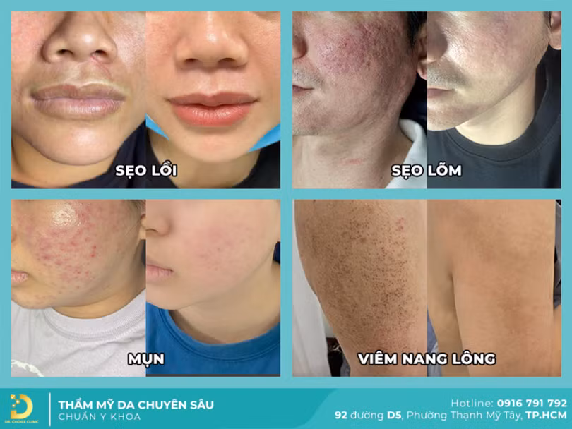da-lieu-uy-tin-chuyen-hcm-dr-choice-clinic-5054.png