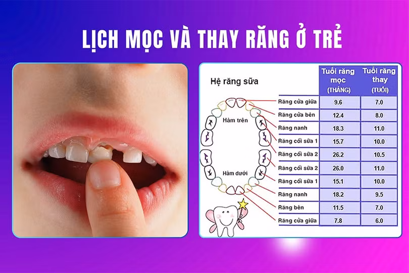 bht - thay răng sữa 2.jpg