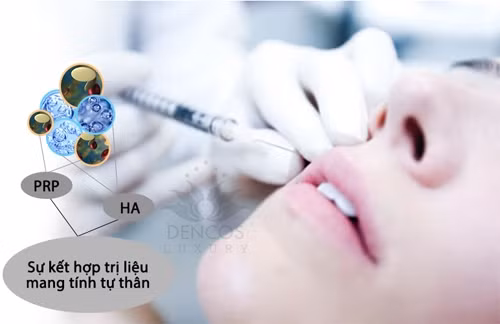 Làm đầy hóp má, trẻ hóa mặt già nua ảnh 2