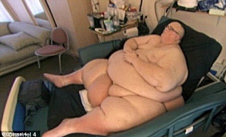 Paul Mason từng nặng tới 445kg và mất khả năng đi lại, anh phải nằm trên giường bệnh và được các nhân viên y tế chăm sóc.