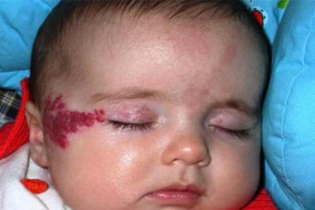 Phép màu đã đến với em bé bị ung thư “kép” ở Hà Tĩnh