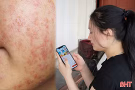 Mỹ phẩm online: Dễ mua - khó kiểm chứng chất lượng
