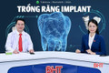 Talkshow: Trồng răng Implant - lựa chọn hàng đầu cho người mất răng