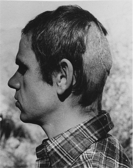 Nhà quay phim Jan de Bont với vết thương khá nghiêm trọng trên đầu vì bị sư tử tấn công.