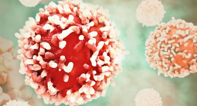 Tìm ra phương pháp ngăn chặn giai đoạn nguy hiểm chết người của bệnh ung thư