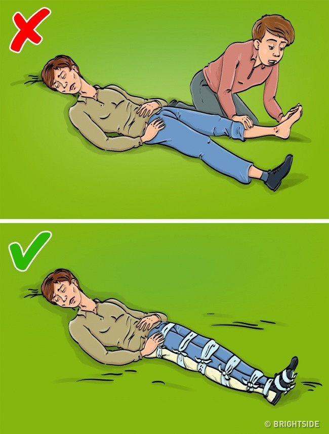 10 sai lầm thường gặp khi sơ cứu người bị thương ảnh 10 10 sai lam thuong gap khi so cuu nguoi bi thuong