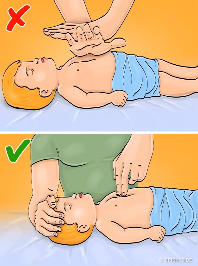 10 sai lầm thường gặp khi sơ cứu người bị thương ảnh 5 10 sai lam thuong gap khi so cuu nguoi bi thuong