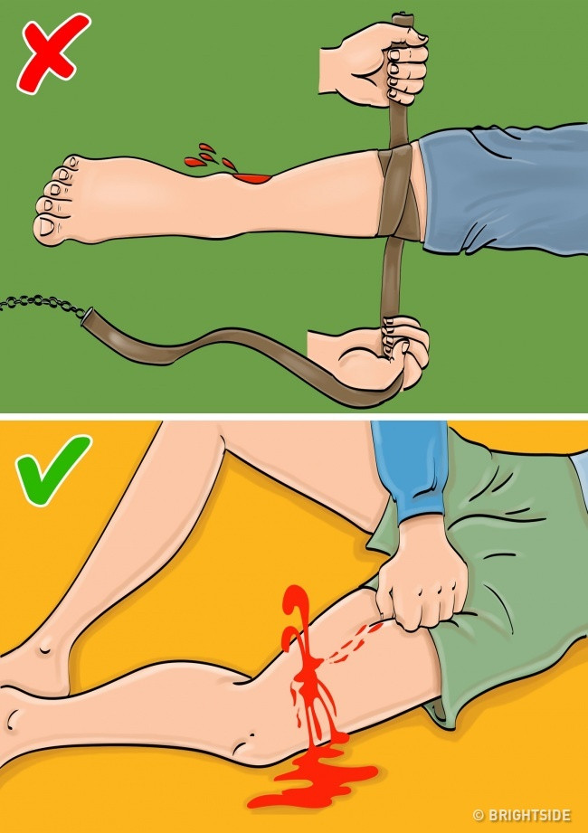 10 sai lầm thường gặp khi sơ cứu người bị thương ảnh 2 10 sai lam thuong gap khi so cuu nguoi bi thuong