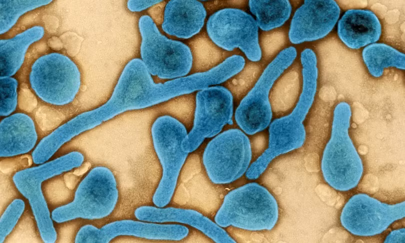 Virus khiến 9 người Guinea Xích đạo chết nguy hiểm thế nào