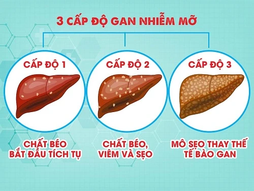 4 món ăn bài thuốc phòng trị gan nhiễm mỡ