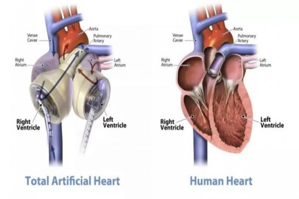 Cấu tạo của trái tim nhân tạo tương tự tim người. “Giấc mơ bất tử” sẽ thành hiện thực nhờ trái tim nhân tạo?