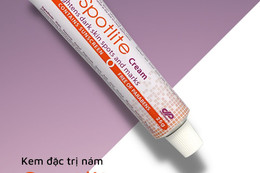 Kem trị nám, tàn nhang Spotlite có tốt không?